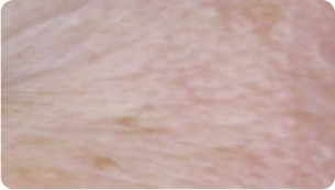 After treatment