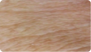 Before treatment